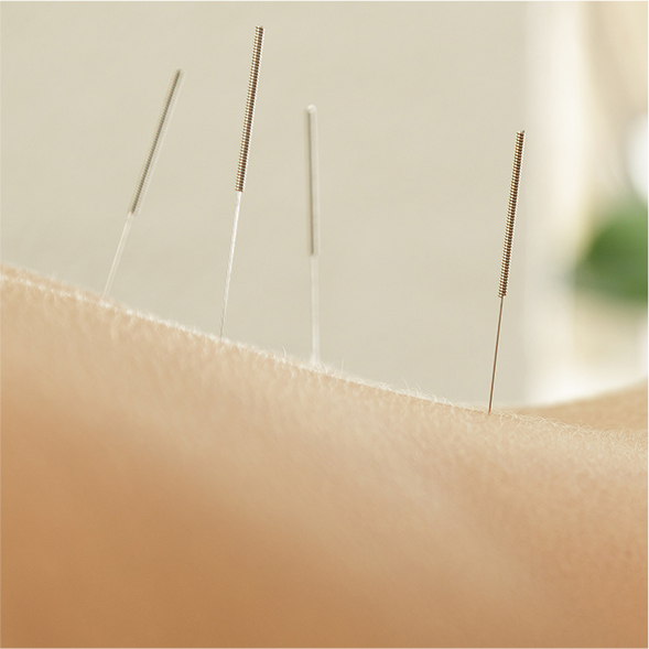Acupuncture Close Up
